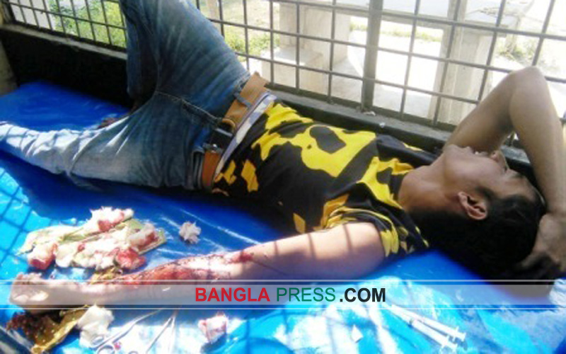 গুরুদাসপুরে কলেজ ছাত্রকে ক্ষুর মেরে পালালো দুর্বৃত্ত