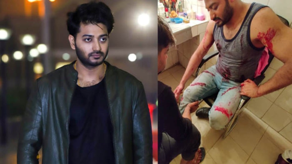 শুটিংয়ে আহত বাপ্পি