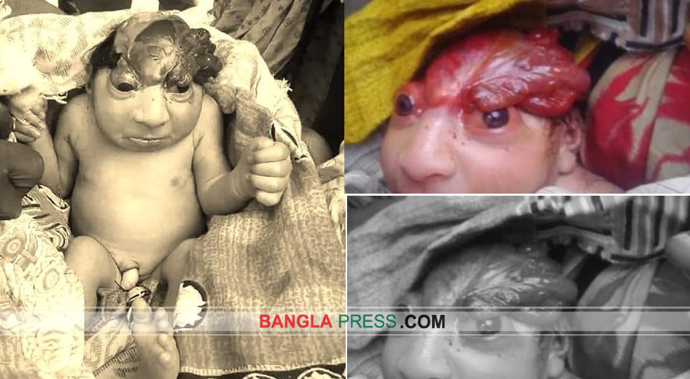 ঝিনাইদহে অদ্ভুত কন্যা সন্তানের জন্ম, দেখতে জনতার ভিড়