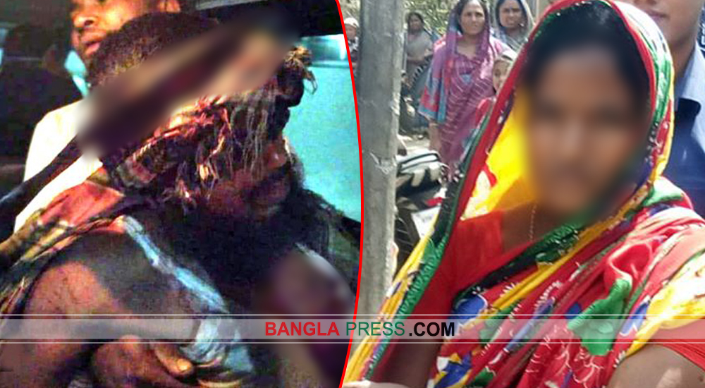 গভীর রাতে বিছানায় স্বামীর মাথায় দা দিয়ে কুপিয়েছে স্ত্রী !