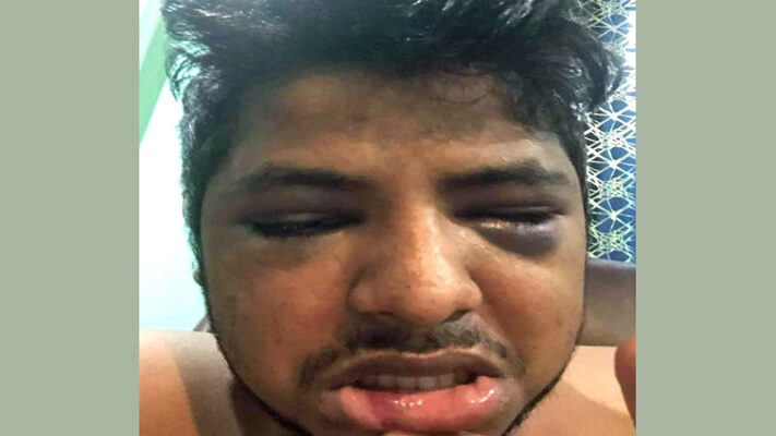 নিউ ইয়র্কে ফের কৃষ্ণাঙ্গ দুর্বৃত্তের হামলার শিকার বাংলাদেশি