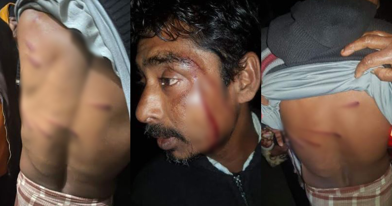 দুই শ্রমিককে বেধড়ক পেটালো কাউন্সিলর, থানায় অভিযোগ