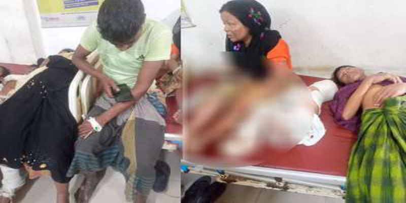ভাসাচর রোহিঙ্গা ক্যাম্পে গ্যাস সিলিন্ডার বিস্ফোরণে ৫শিশু সহ ৯জন দগ্ধ