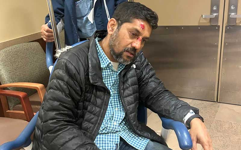 নিউ ইয়র্কে দুর্বৃত্তের হামলায় বাংলাদেশি ফটো সাংবাদিক আহত